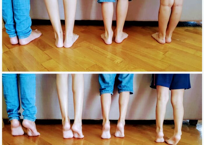Mi niño tiene los pies planos … ¿Cuándo tengo que consultar?